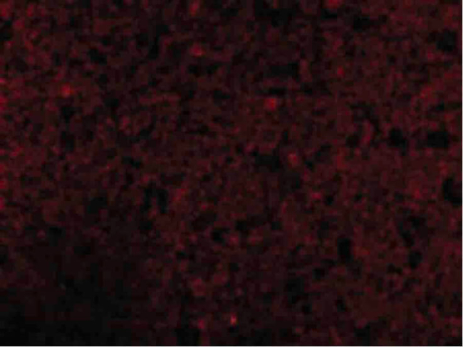 CRMP1 Antibody in Immunocytochemistry (ICC/IF)