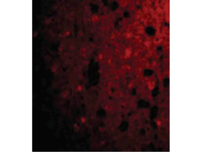 CRMP1 Antibody in Immunocytochemistry (ICC/IF)