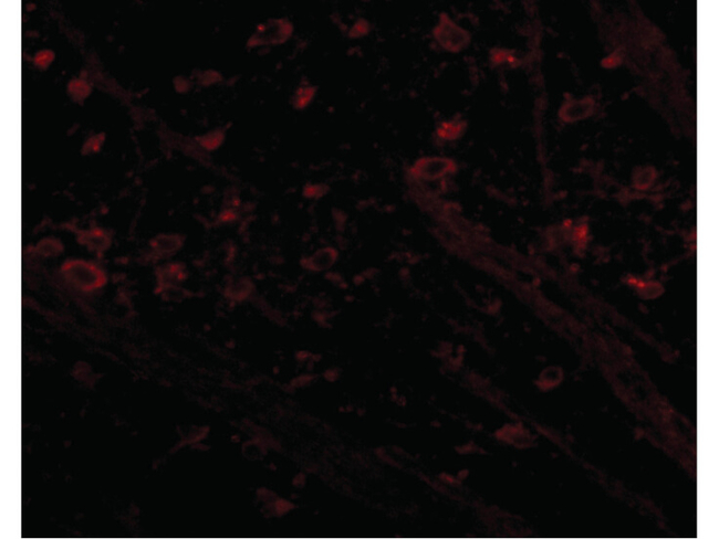 CRMP1 Antibody in Immunocytochemistry (ICC/IF)