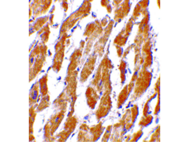 CRTH2 Antibody in Immunohistochemistry (Paraffin) (IHC (P))
