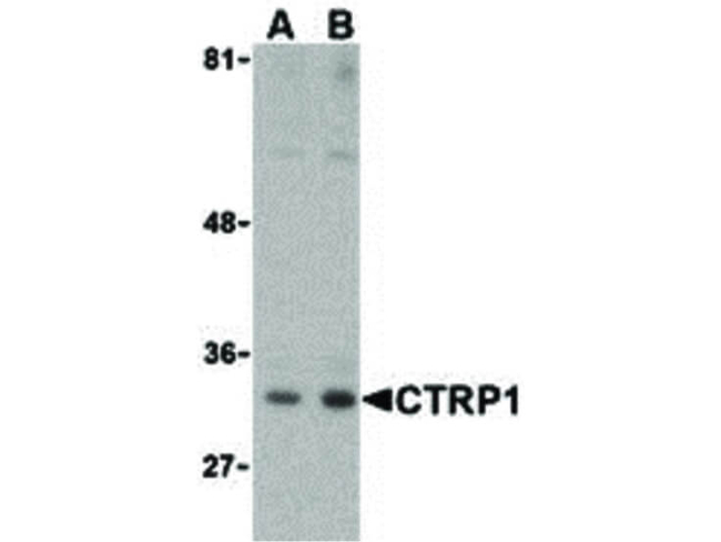 CTRP1 Antibody in Western Blot (WB)