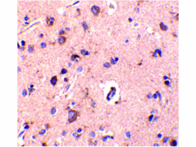 CTRP2 Antibody in Immunohistochemistry (Paraffin) (IHC (P))