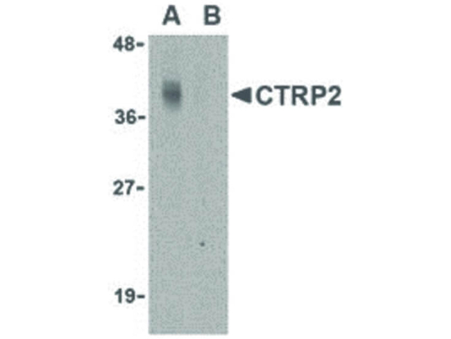 CTRP2 Antibody in Western Blot (WB)