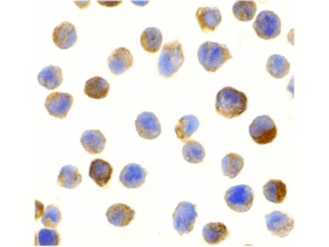 CTRP2 Antibody in Immunocytochemistry (ICC/IF)