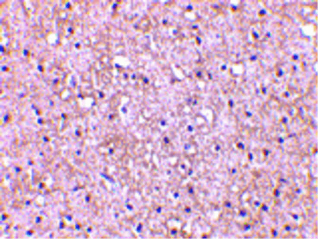 CTRP5 Antibody in Immunohistochemistry (Paraffin) (IHC (P))