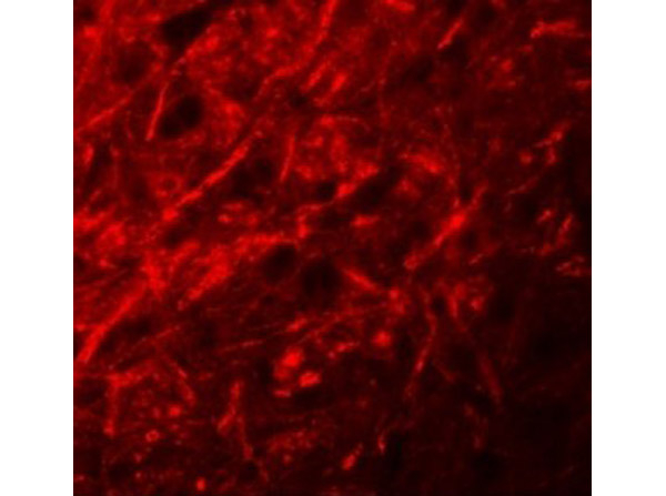 CTTNBL1 Antibody in Immunocytochemistry (ICC/IF)