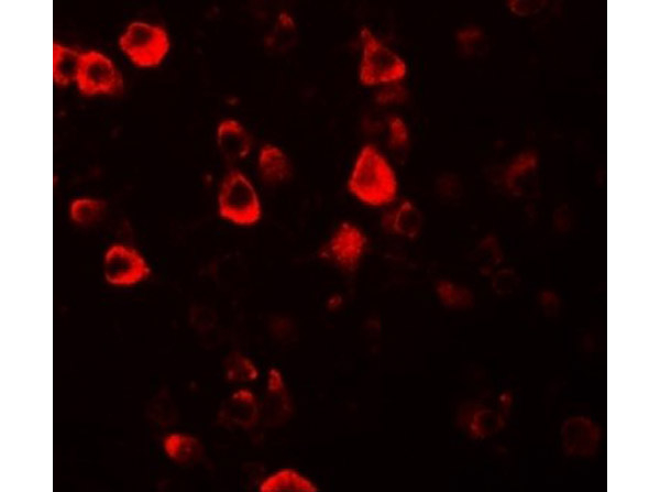 CXXC4 Antibody in Immunocytochemistry (ICC/IF)