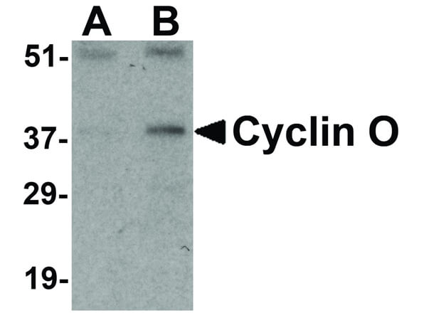 Cyclin O Antibody in Western Blot (WB)