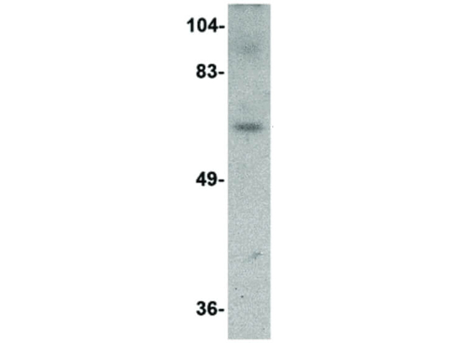 Dact3 Antibody in Western Blot (WB)