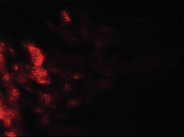 DAF Antibody in Immunocytochemistry (ICC/IF)
