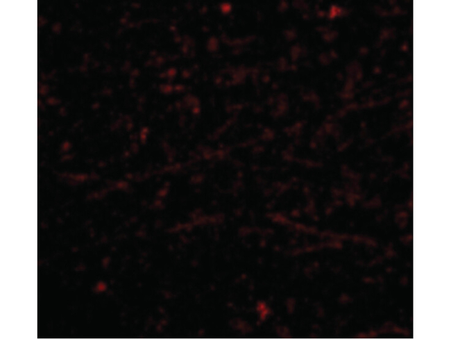 DARC Antibody in Immunohistochemistry (Paraffin) (IHC (P))
