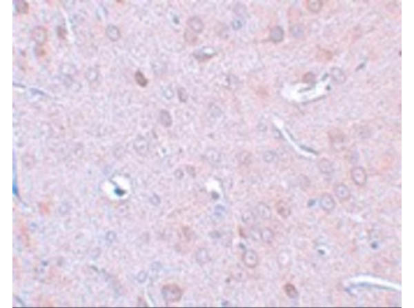 DCLK1 Antibody in Immunohistochemistry (Paraffin) (IHC (P))