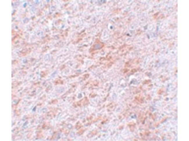 DCLK2 Antibody in Immunohistochemistry (Paraffin) (IHC (P))