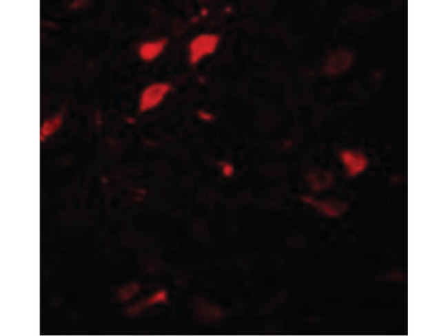 DCLK3 Antibody in Immunocytochemistry (ICC/IF)