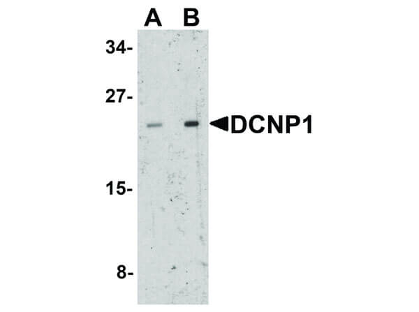 DCNP1 Antibody in Western Blot (WB)