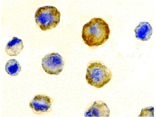 DcR1 Antibody in Immunocytochemistry (ICC/IF)