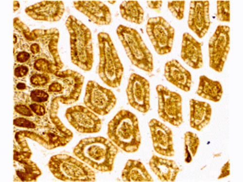 DC-SIGN Antibody in Immunohistochemistry (Paraffin) (IHC (P))