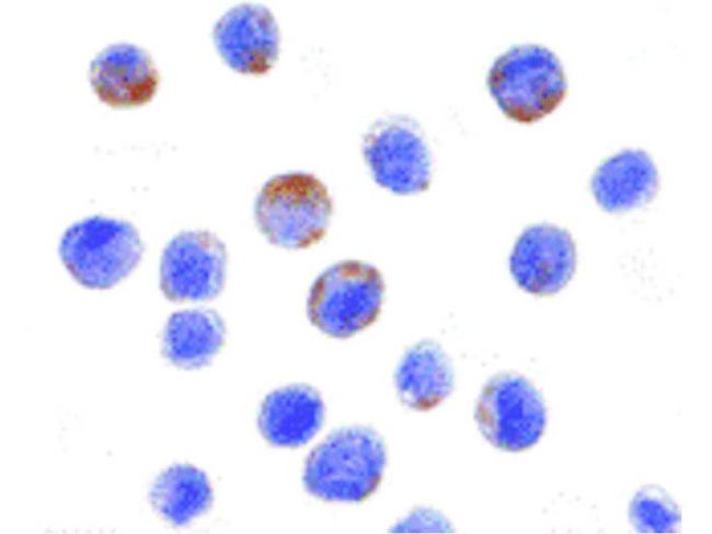 DDX3 Antibody in Immunocytochemistry (ICC/IF)