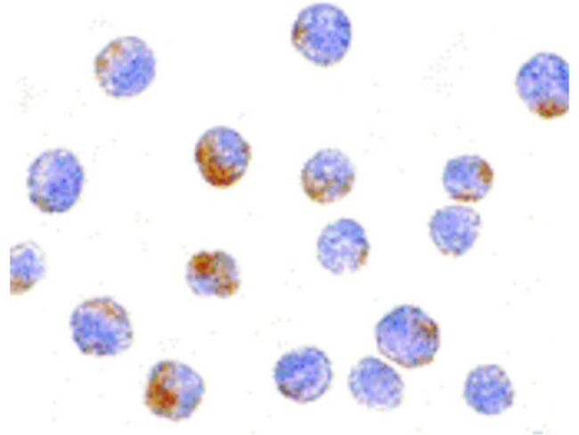 DDX3 Antibody in Immunocytochemistry (ICC/IF)
