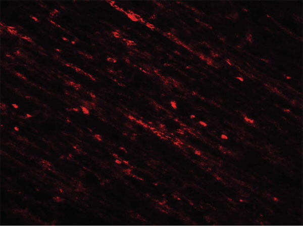 DENR Antibody in Immunocytochemistry (ICC/IF)