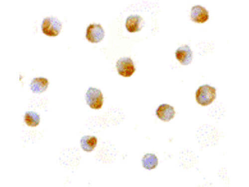 DFF40 Antibody in Immunocytochemistry (ICC/IF)