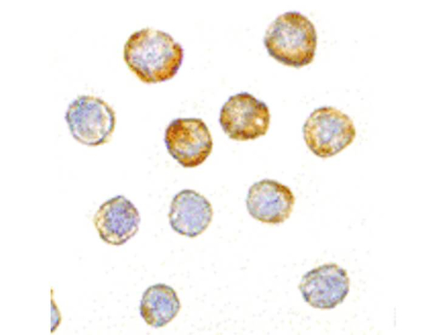 DISC1 Antibody in Immunocytochemistry (ICC/IF)