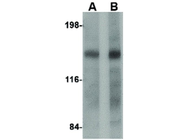 DISP2 Antibody in Western Blot (WB)