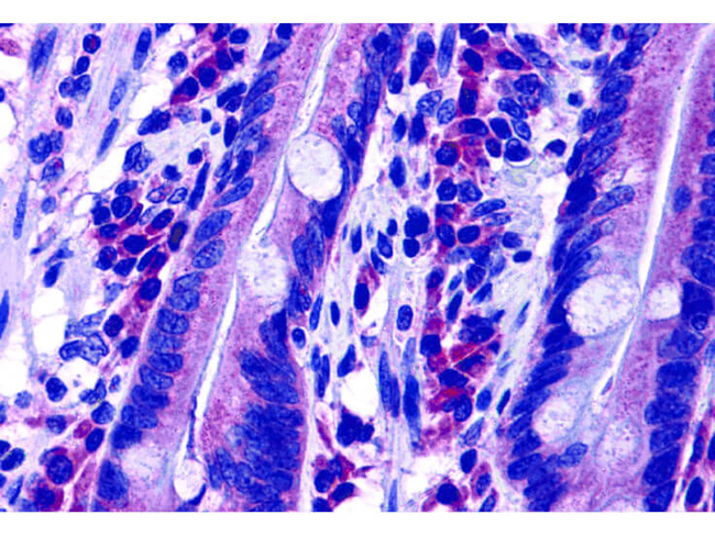 DISP2 Antibody in Immunohistochemistry (Paraffin) (IHC (P))