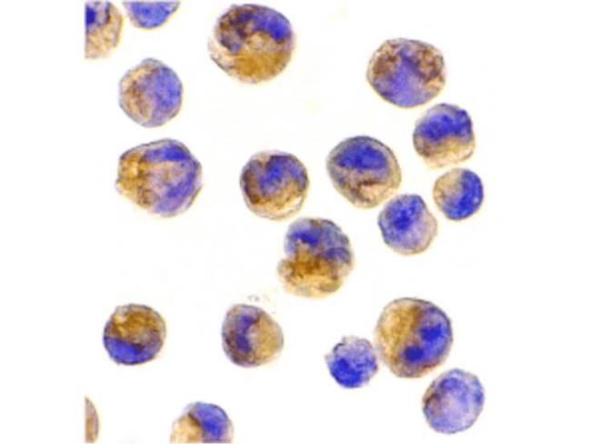 DOK1 Antibody in Immunocytochemistry (ICC/IF)