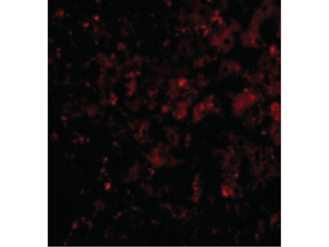 DRAM Antibody in Immunocytochemistry (ICC/IF)