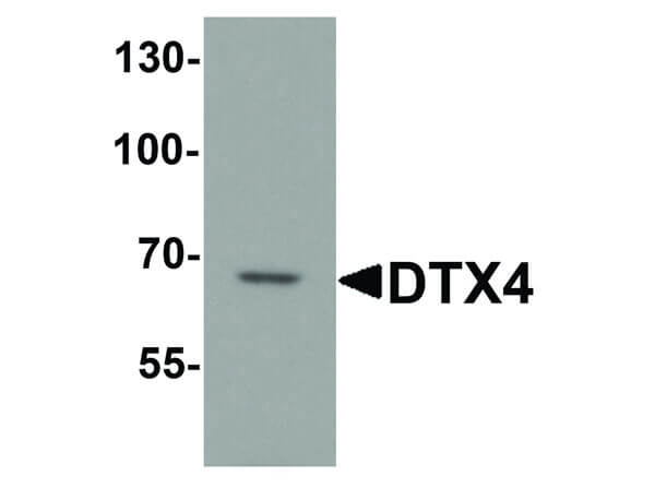 DTX4 Antibody in Western Blot (WB)
