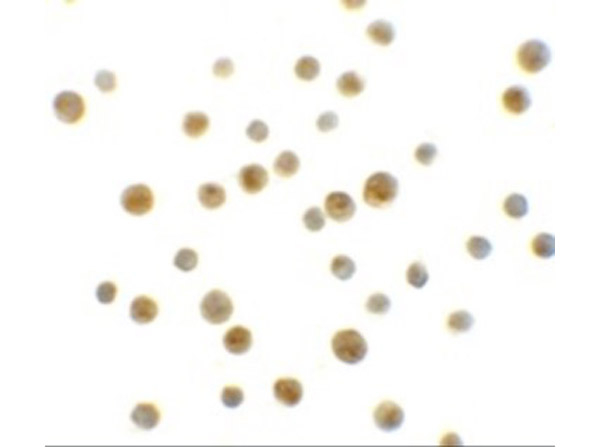 DYRK1A Antibody in Immunocytochemistry (ICC/IF)