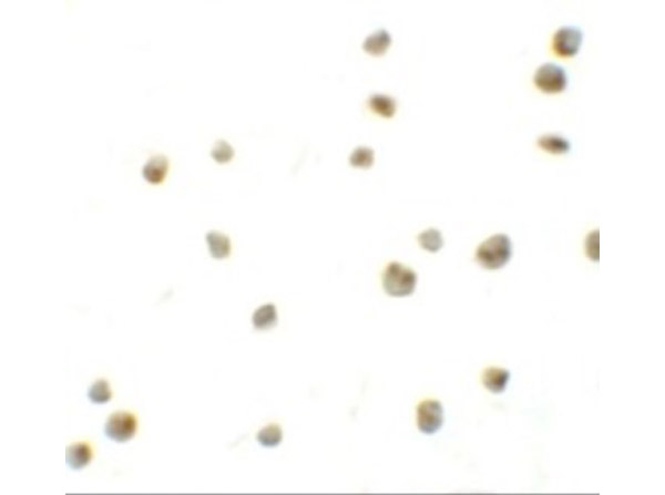 DYRK2 Antibody in Immunocytochemistry (ICC/IF)