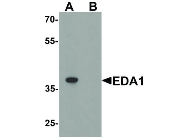 EDA1 Antibody in Western Blot (WB)