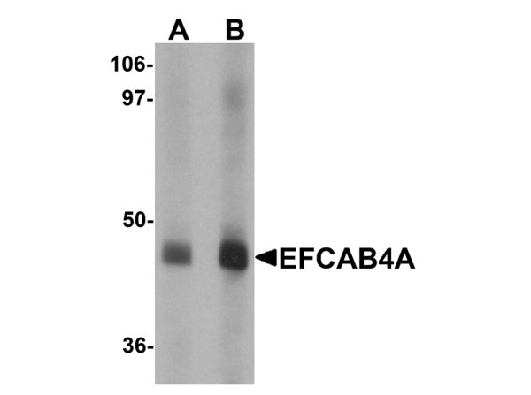EFCAB4A Antibody in Western Blot (WB)