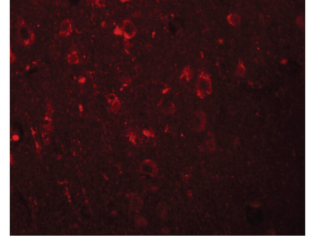 EFHD2 Antibody in Immunocytochemistry (ICC/IF)