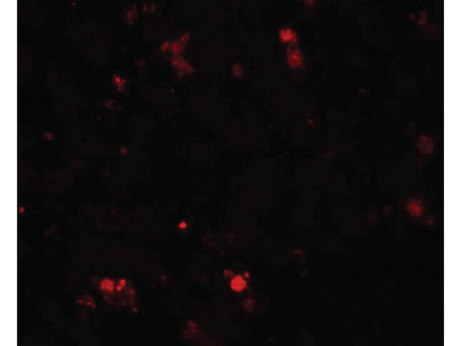 ELOVL7 Antibody in Immunocytochemistry (ICC/IF)