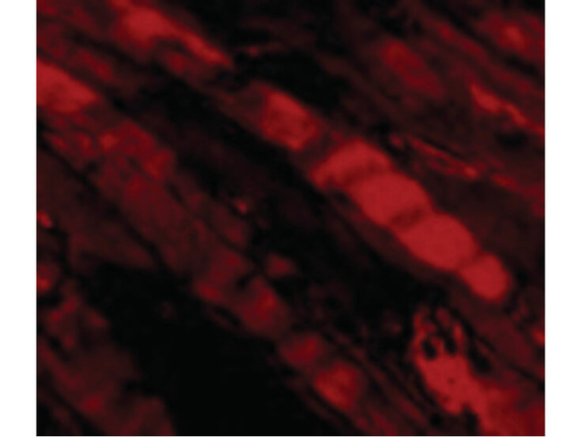 Emerin Antibody in Immunocytochemistry (ICC/IF)