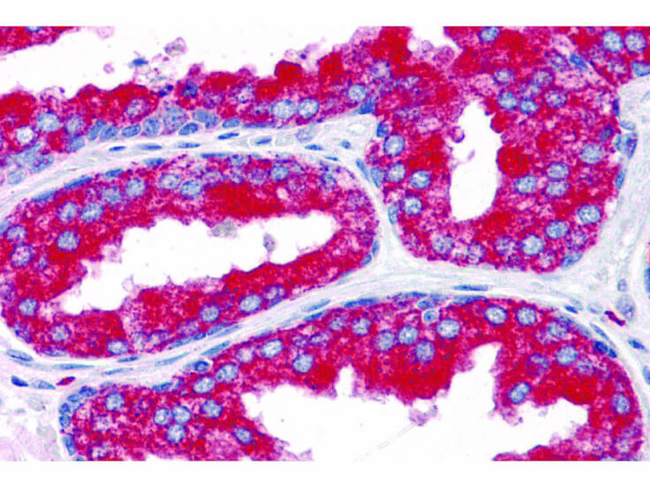 EMX2 Antibody in Immunohistochemistry (Paraffin) (IHC (P))