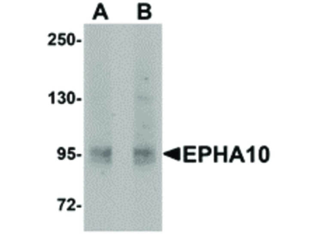 EphA10 Antibody in Western Blot (WB)