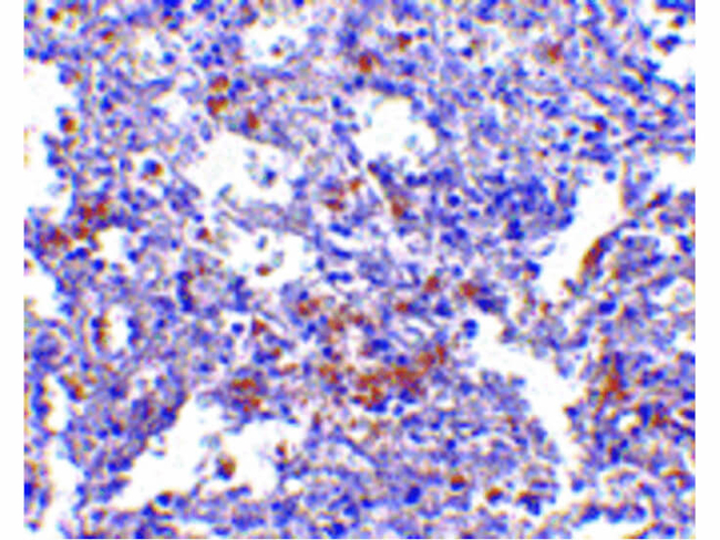EVER1 Antibody in Immunohistochemistry (Paraffin) (IHC (P))