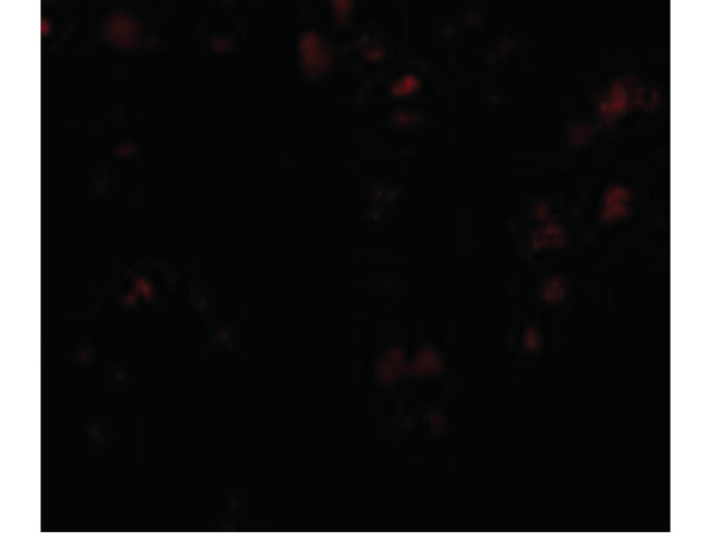 EVER1 Antibody in Immunocytochemistry (ICC/IF)