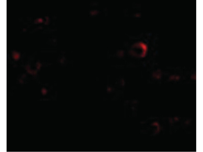 EVER2 Antibody in Immunocytochemistry (ICC/IF)