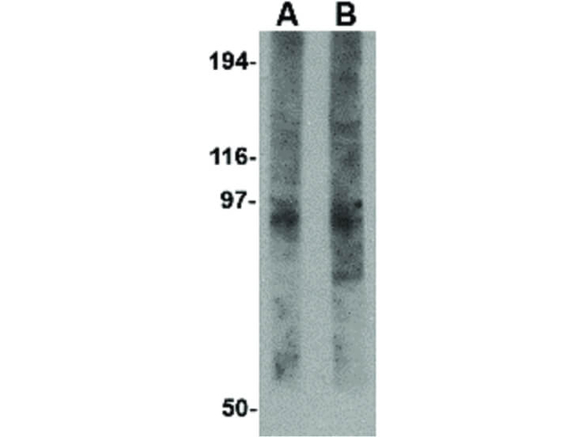 EVER2 Antibody in Western Blot (WB)