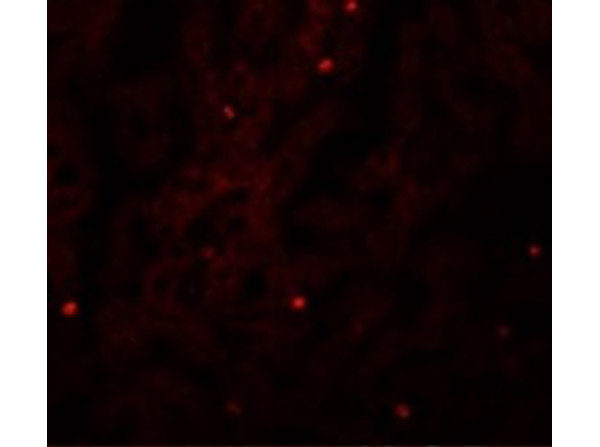 FAM59A Antibody in Immunocytochemistry (ICC/IF)