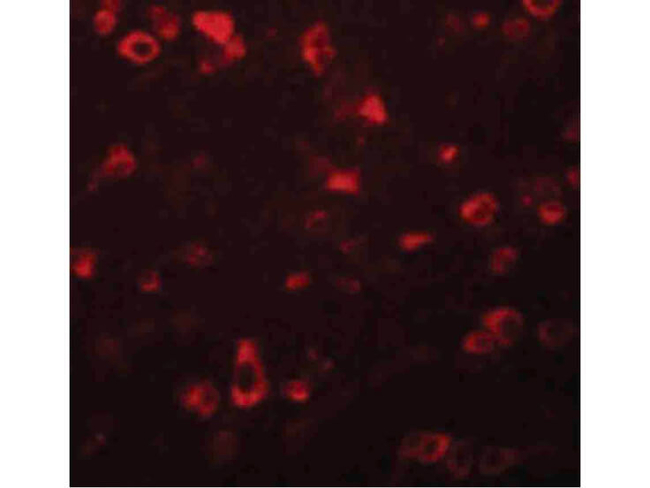 FAM59B Antibody in Immunocytochemistry (ICC/IF)