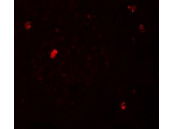 FBXL16 Antibody in Immunocytochemistry (ICC/IF)