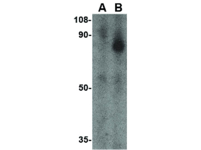 FEZ1 Antibody in Western Blot (WB)