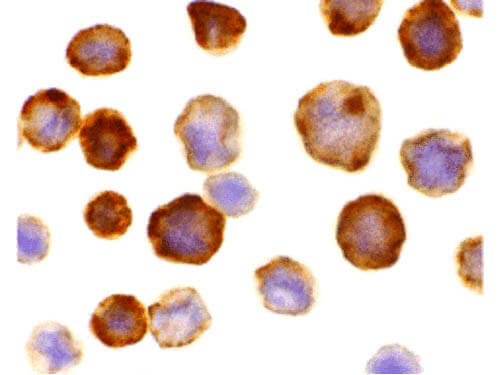 FLASH Antibody in Immunocytochemistry (ICC/IF)