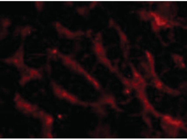 FN14 Antibody in Immunocytochemistry (ICC/IF)